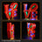 Lightailing Light Kit For LEGO LOVE 31214-9